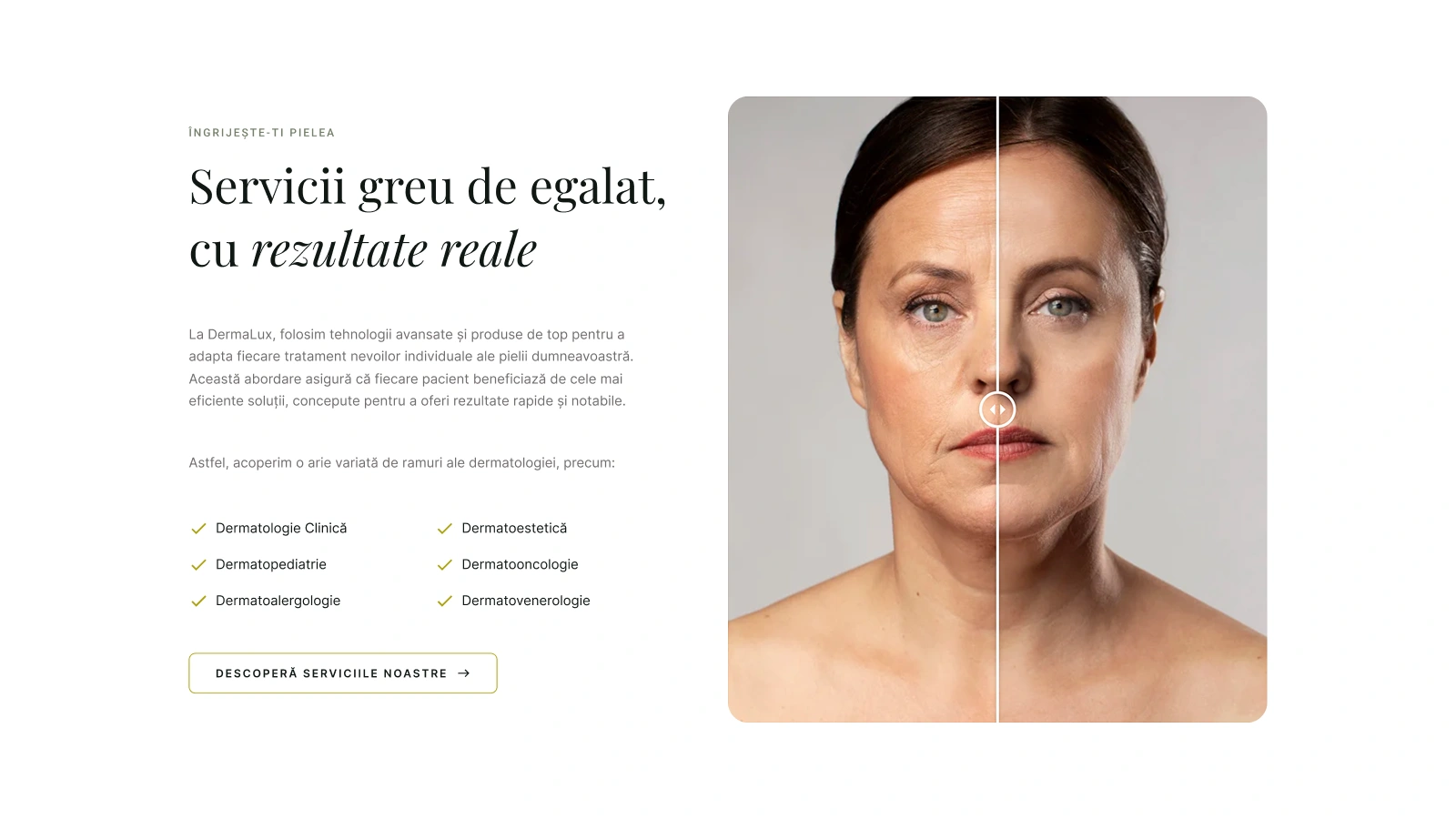 Secțiune website DermaLux cu lista de servicii dermatologice: dermatologie clinică, dermatopediatrie, dermatoalergologie, dermoestetică, dermatooncologie, dermatovenerologie